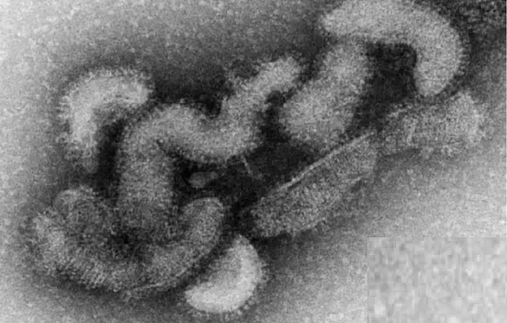 日本が新型オズウイルスによる世界初の死者を記録 – OCPニュース